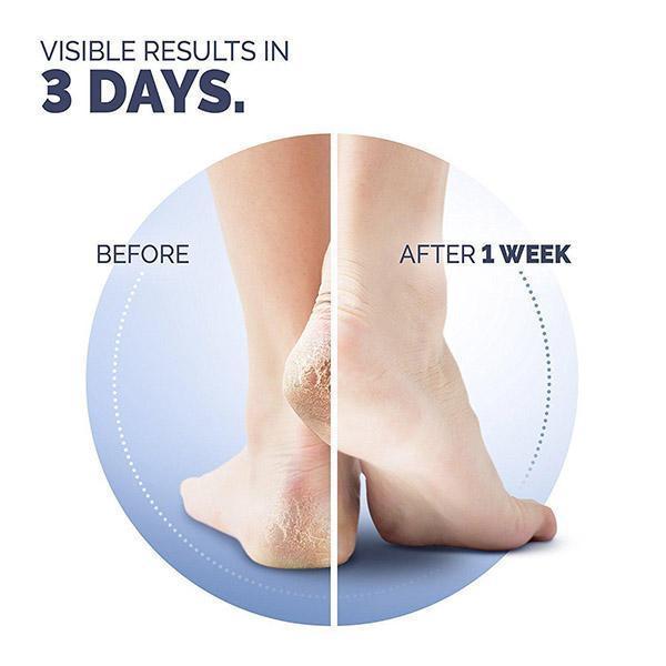 2-Pack Cracked Heel Repair Balm: Active Repair K+ - Image 4