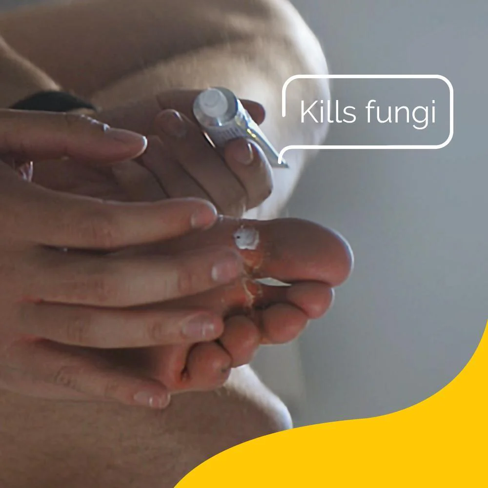 Athlete's Foot Cream - Image 4