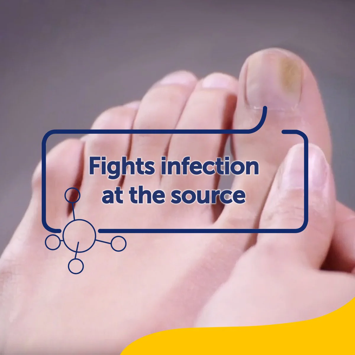Fungal Nail Treatment - Image 4